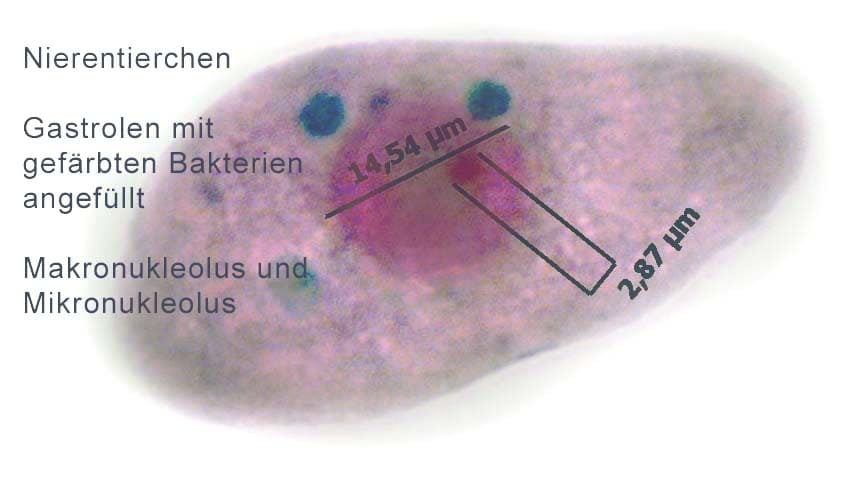 Nierentierchen unter dem Mikroskop