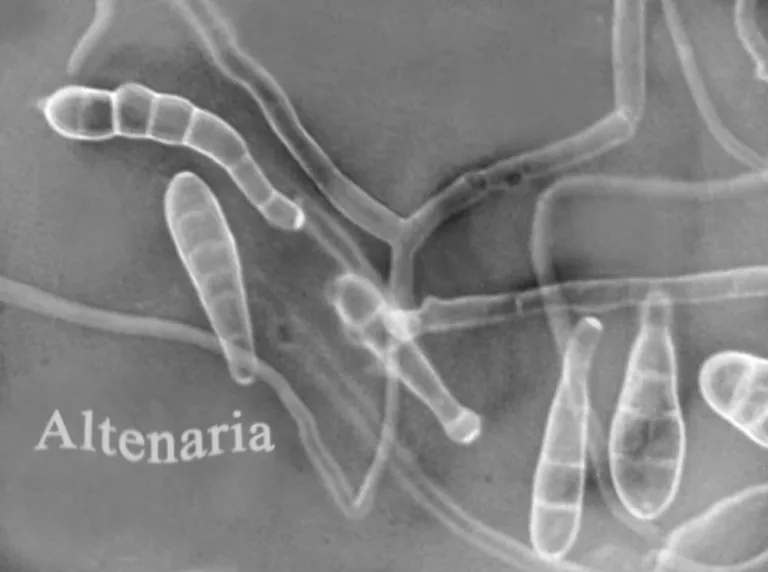 Alternaria
