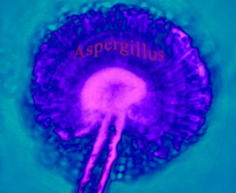 Aspergillus