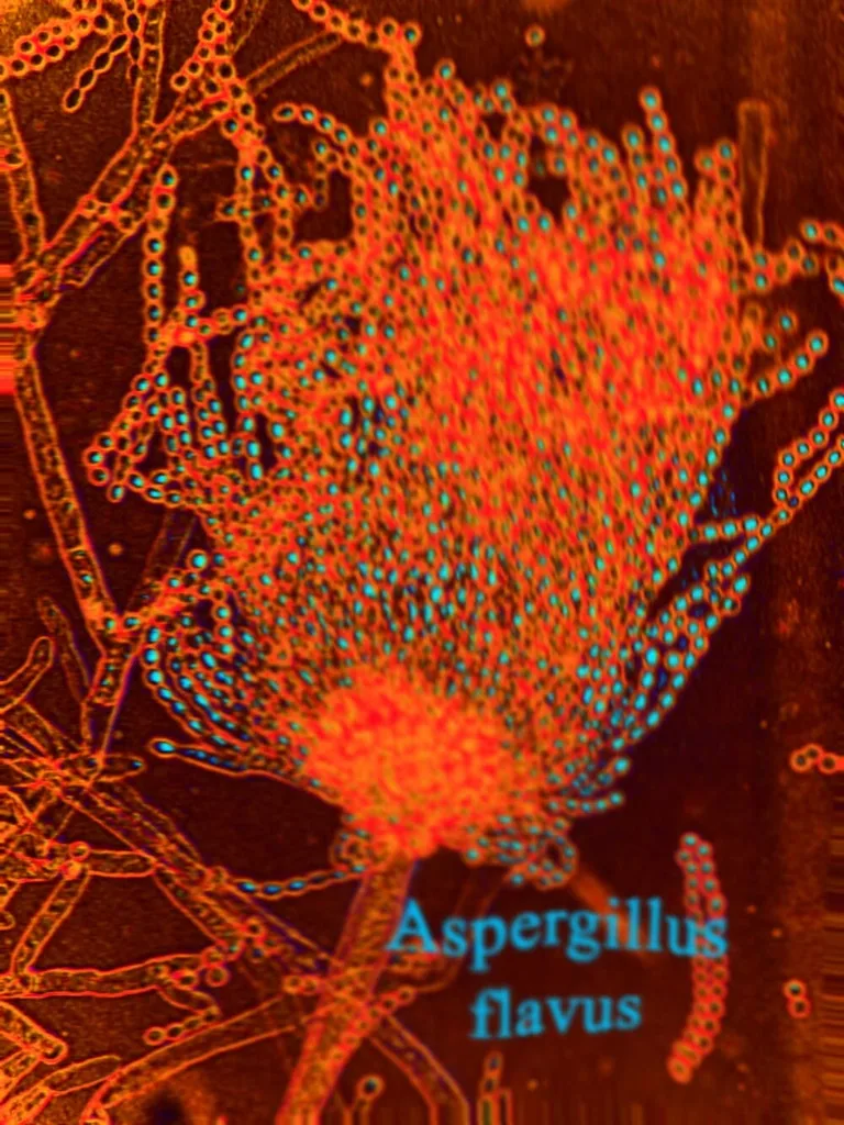 Aspergillus 2